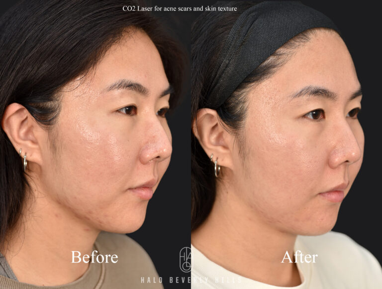 Ke Co2 Right 3qt View Copy